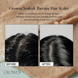 GROWUS Sea Salt Therapy Scalp Scaler