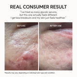 Arencia Eraser Shot Glycolic Acid Booster