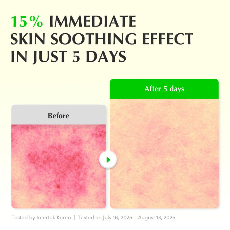 EQQUALBERRY Aloe PDRN Calming Serum