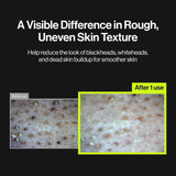 UNLEASHIA Two Step Zero Pore Overnight Bubble Mask