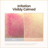 Cell Fusion C Skin Blemish Balm Intensive