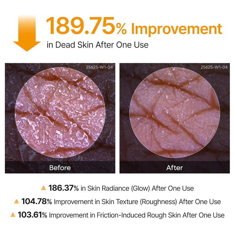 Dr.Melaxin Peel Shot Exfoliating Kojic Acid Turmeric Spray