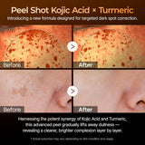 Dr.Melaxin Peel Shot Exfoliating Kojic Acid Turmeric Serum