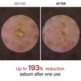 Dr.Melaxin Peel Shot Exfoliant Black Rice Ampoule