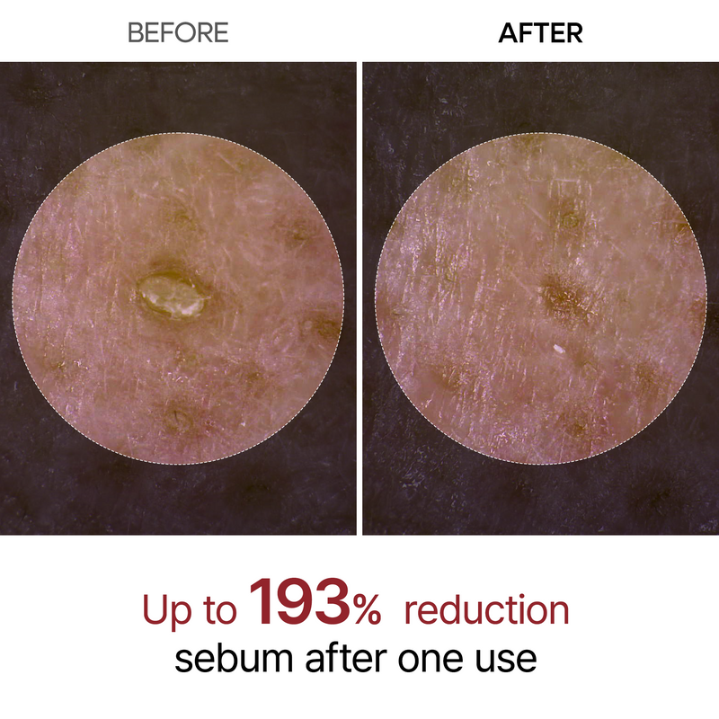 Dr.Melaxin Peel Shot Exfoliant Black Rice Ampoule